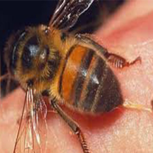 فوت دختر جوان بر اثر نیش زنبور!