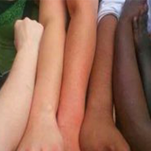 چرا رنگ پوست انسان‌ها فرق می‌کند؟