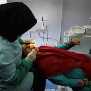 ایرانی ها در سفید کردن دندان ها از ژاپنی ها پیش افتاده اند