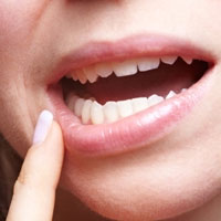 زخم‌های بیش از 15 روز در دهان را جدی بگیرید