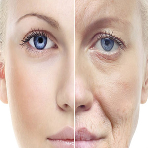علایم پیر شدن پوست و روش های پیشگیری