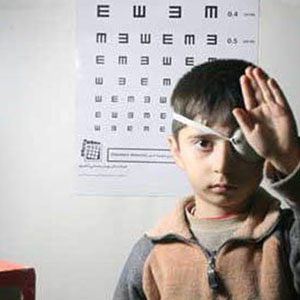 ابتلای حدود 5 درصد کودکان ایرانی به تنبلی چشم