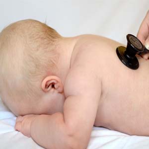 عفونت شایع ترین علت کاهش پلاکت در دوران نوزادی است