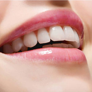 روش‌های اصولی برای سفید کردن دندان