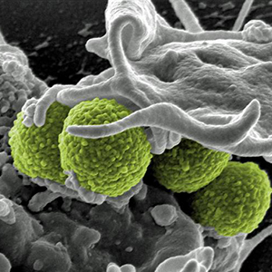 شناسایی ۷۶ ژن جدید مقاوم به آنتی بیوتیک