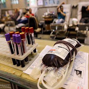 شیب کاهشی سه ویروس عفونی در اهداکنندگان خون ایرانی