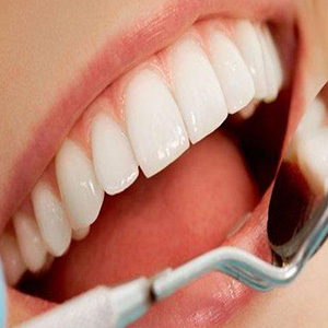 داشتن «لبخند هالیودی» عارضه دارد/ حساسیت و پوسیدگی دندان ها