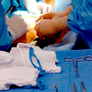 نادرترین جراحی پزشکی: دختربچه‌ای با ۲ آلت زنانه و ۲ رحم جداگانه!