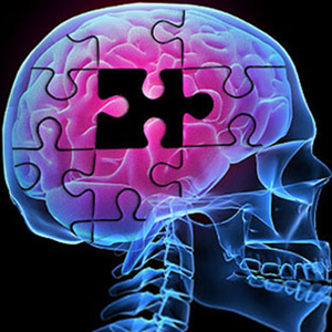 آلزایمر چه بلایی سر مغز می‌آورد؟