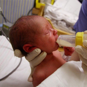 80 درصد نوزادانی که نارس به دنیا می‌آیند زردی دارند