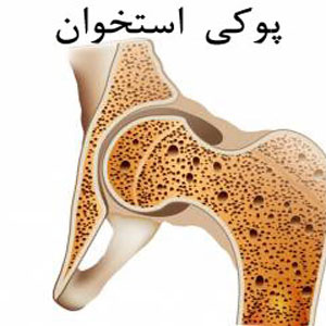 واکنش سازمان غذاودارو به اظهارات رئیس انجمن روماتولوژی