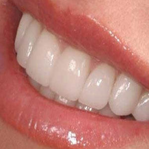 چند راهکار ساده خانگی برای سفید کردن دندان ها