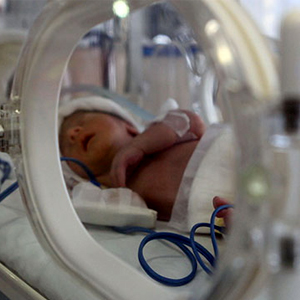 علت تولد پیش از موعد نوزادان در ایران چیست؟