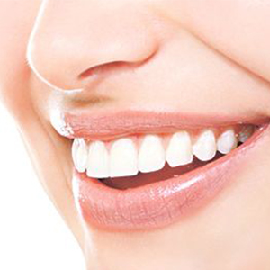 بلایی که پودرهای سفید کننده بر سر دندان می‌آورند