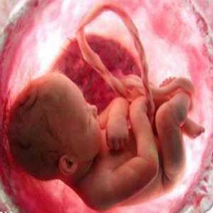 بیشترسقط درمانی ها مربوط به اختلال جنینی است/رشد 6،8درصدی سقط درمانی