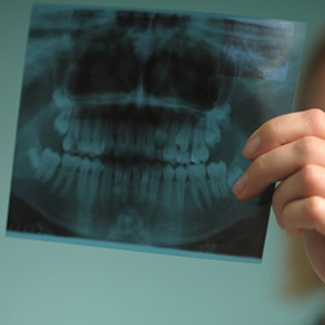 استفاده از رادیوگرافی پانورامیک جهت بررسی سلامت ریشه دندان‌ها