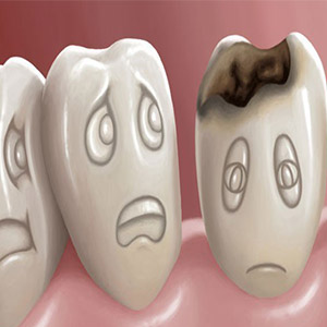 شاخص پوسیدگی دندان در کشور افزایش یافته است