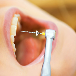دلیل حساس شدن دندان‌ها پس از ترمیم چیست؟