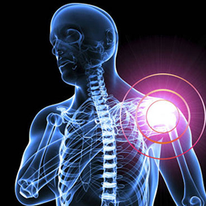 دردهای عضلانی در شانه را چگونه درمان کنیم؟