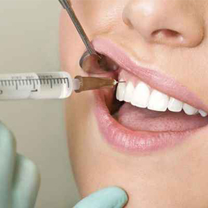 هر آنچه باید در مورد درمان ریشه دندان بدانید