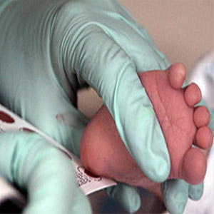 غربالگری 20 بیماری متابولیک در نوزادان ایرانی