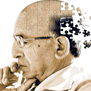 تشخیص آلزایمر7 سال قبل از بروز اولین علائم