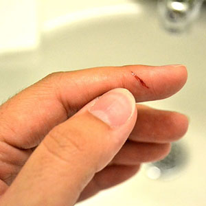 چطور می‌توانید خونریزی بعد از بریدن پوست را بند بیاورید؟