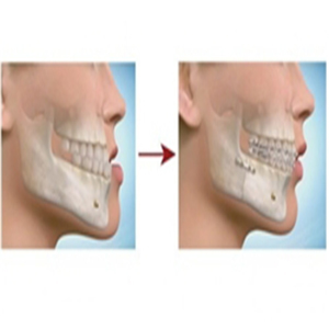 ۳۰ درصد جراحی‌های دهان، فک و صورت مربوط به حوادث است