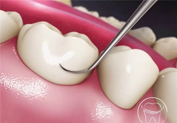 قبل از درمان این موارد را به دندانپزشک بگوئید