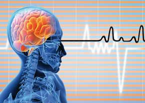 بهبود 30 درصد بیماران سکته مغزی با بوتاکس