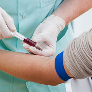 20 سوال مهم درباره آزمایش خون