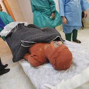 مرگ ۱۶ نفر در چهارشنبه سوری پارسال/ کاهش آسیب با رعایت اصول ایمنی