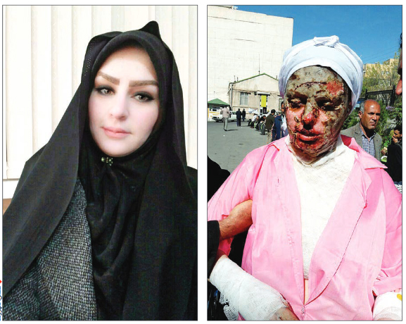 توضیح پزشکی قانونی درباره پرونده اسیدپاشی در تبریز
