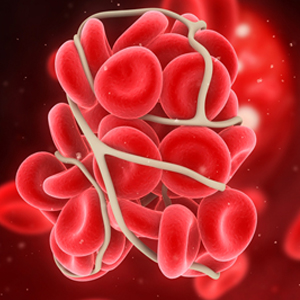 عوامل تاثیرگذار بر افزایش خطر لخته شدن خون را بشناسید