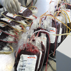 بزرگترین کارخانه تولید کیسه خون کشور امروز افتتاح می شود