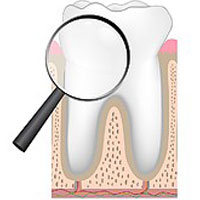 علت سیاه شدن دندان چیست؟