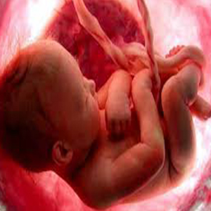 78 مجوز سقط درمانی در فروردین صادر شد