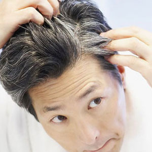 درمان سفیدی مو در خانه با ترکیبی ساده