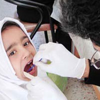 وعده پایان پوسیدگی دندان یک میلیون و 200 هزاردانش آموز برای امسال