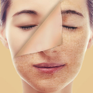 توصیه های طلایی برای درمان خشکی پوست