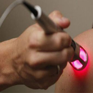 درخواست انجمن متخصصان پوست برای شناسنامه‌دار شدن دستگاه‌های لیزر وارداتی