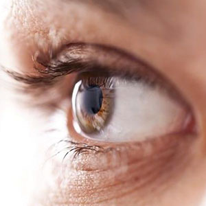 علل بروز دوبینی/ عوارض درمان خودسرانه بیماری‌های چشمی