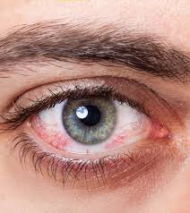 تشخیص آسیب دیدگی چشم با استفاده از اشک