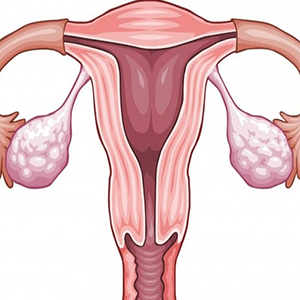 برداشتن تخمدان با بیماری کلیوی مرتبط است