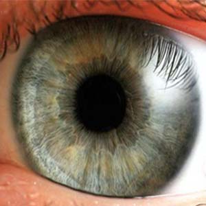 بیماری های تاثیرگذار در بینایی/عیوب انکساری شایع‌ترین اختلالات بینایی در کشور