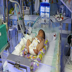 شایع ترین بیماری های کودکان ایرانی/عفونت ها در صدر