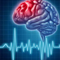 سکته های مغزی و قلبی در 2 درصد بیماران همزمان بروز می کند