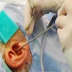 دو نشانه اصلی ابتلا به تومور گوش