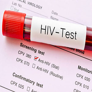 من هم آزمایش اچ آی وی می دهم