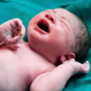 تولد سالانه ۳۰ میلیون نوزاد زودرس در دنیا